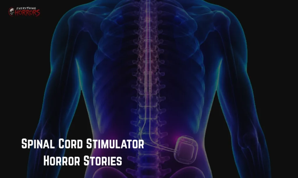 Spinal Cord Stimulator Horror Stories